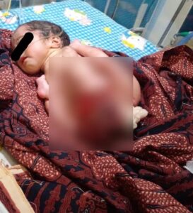 Bayi Perempuan DitemukanDi Teras Warga